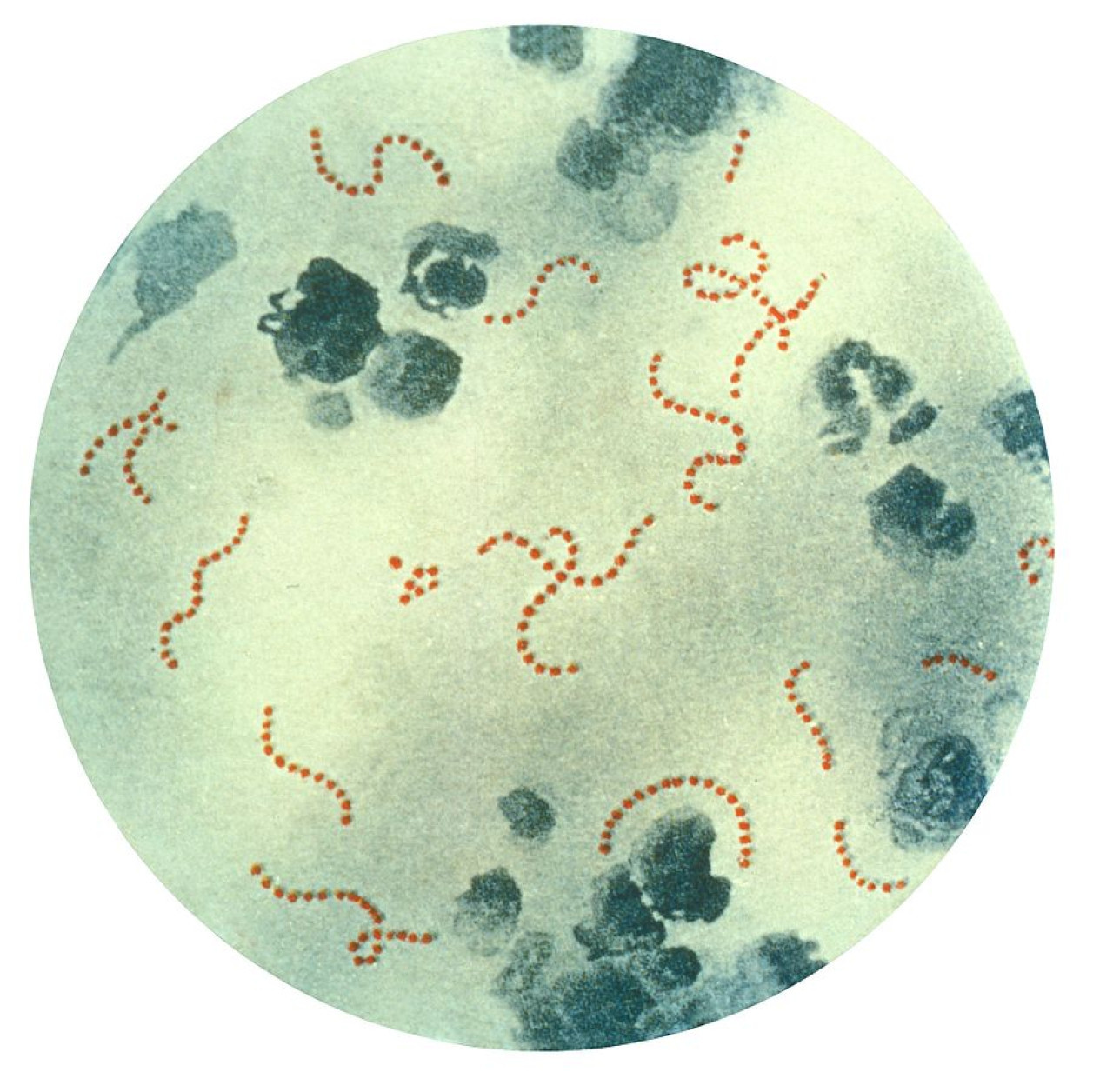 Streptococcus pyogenes. Foto: Wikipedia.