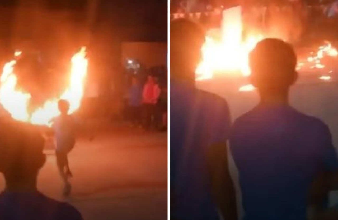 El niño que se prendió fuego está estable. Foto: captura de video.