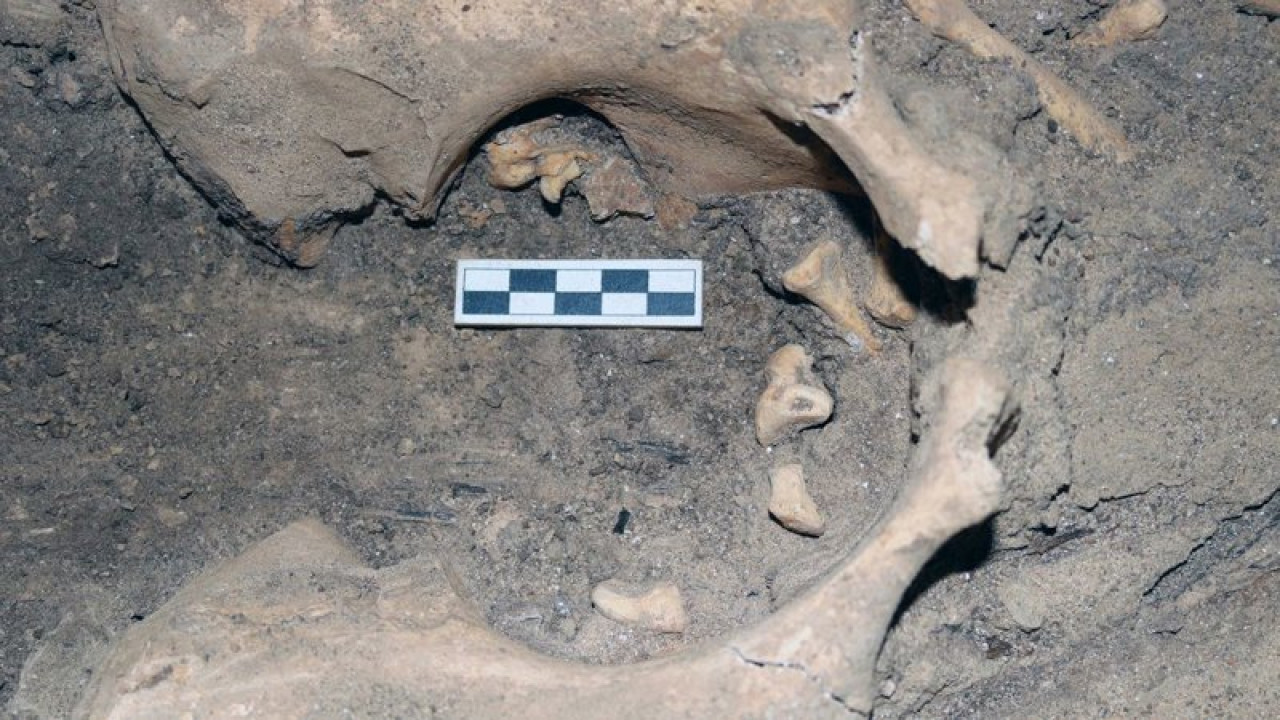 El teratoma ovárico fue encontrado en la pelvis de la mujer. Foto: Proyecto Amarna