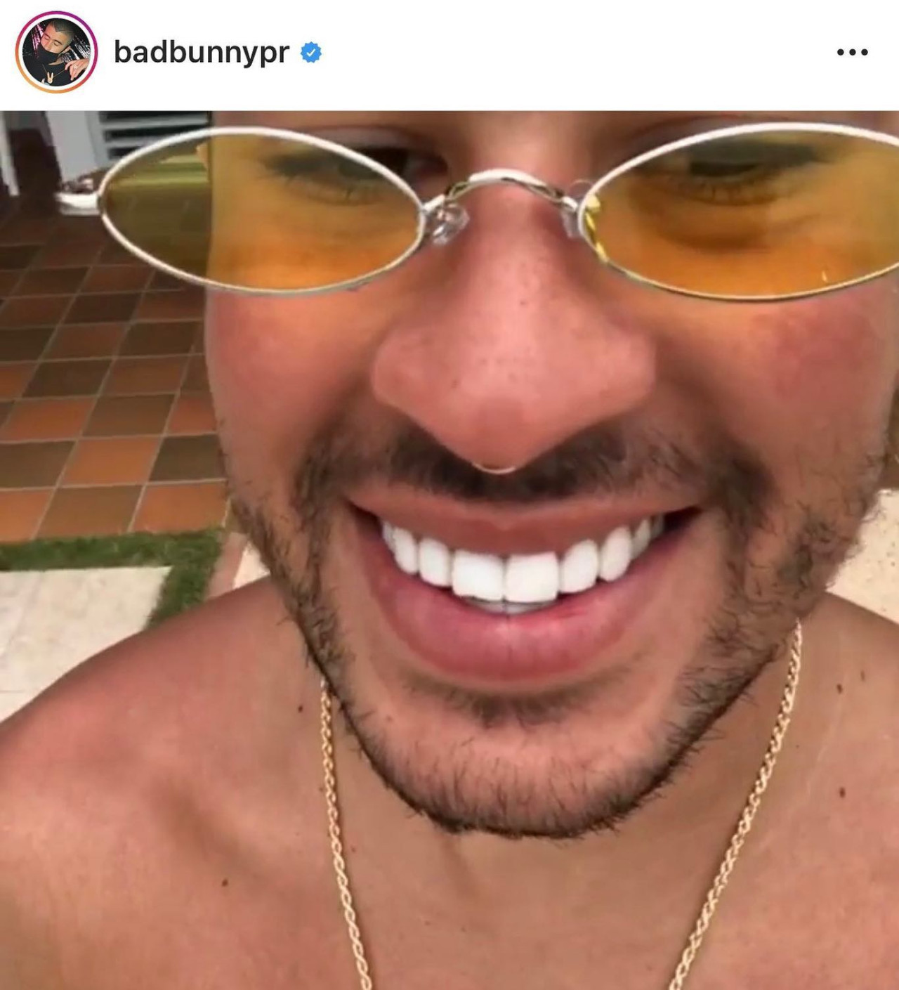 Los dientes de Bad Bunny. Foto: Instagram.