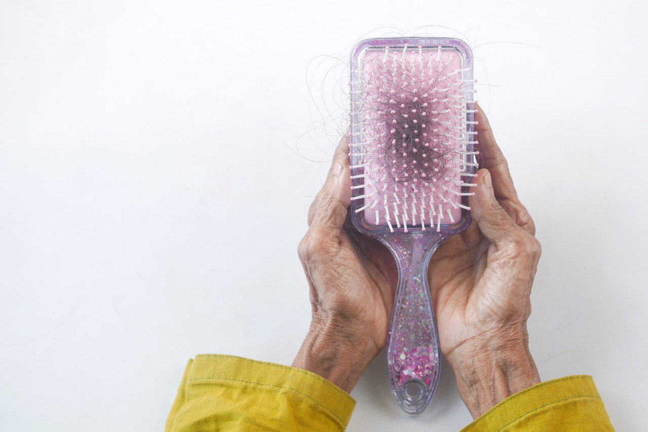 ¿Cuáles son las vitaminas esenciales para evitar la caída de cabello?. Foto: Unsplash