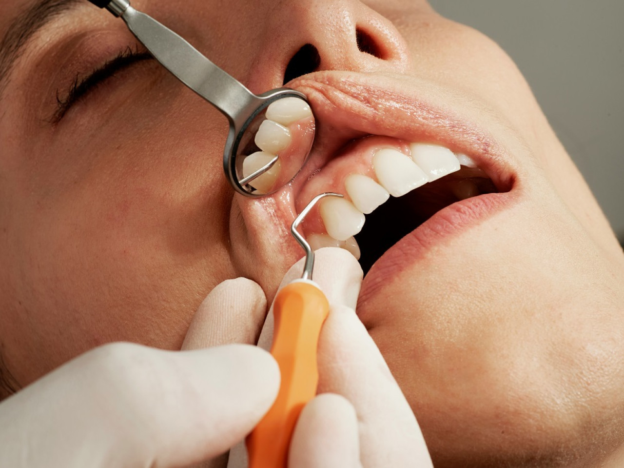 Odontología, dentista. Foto: Unsplash.