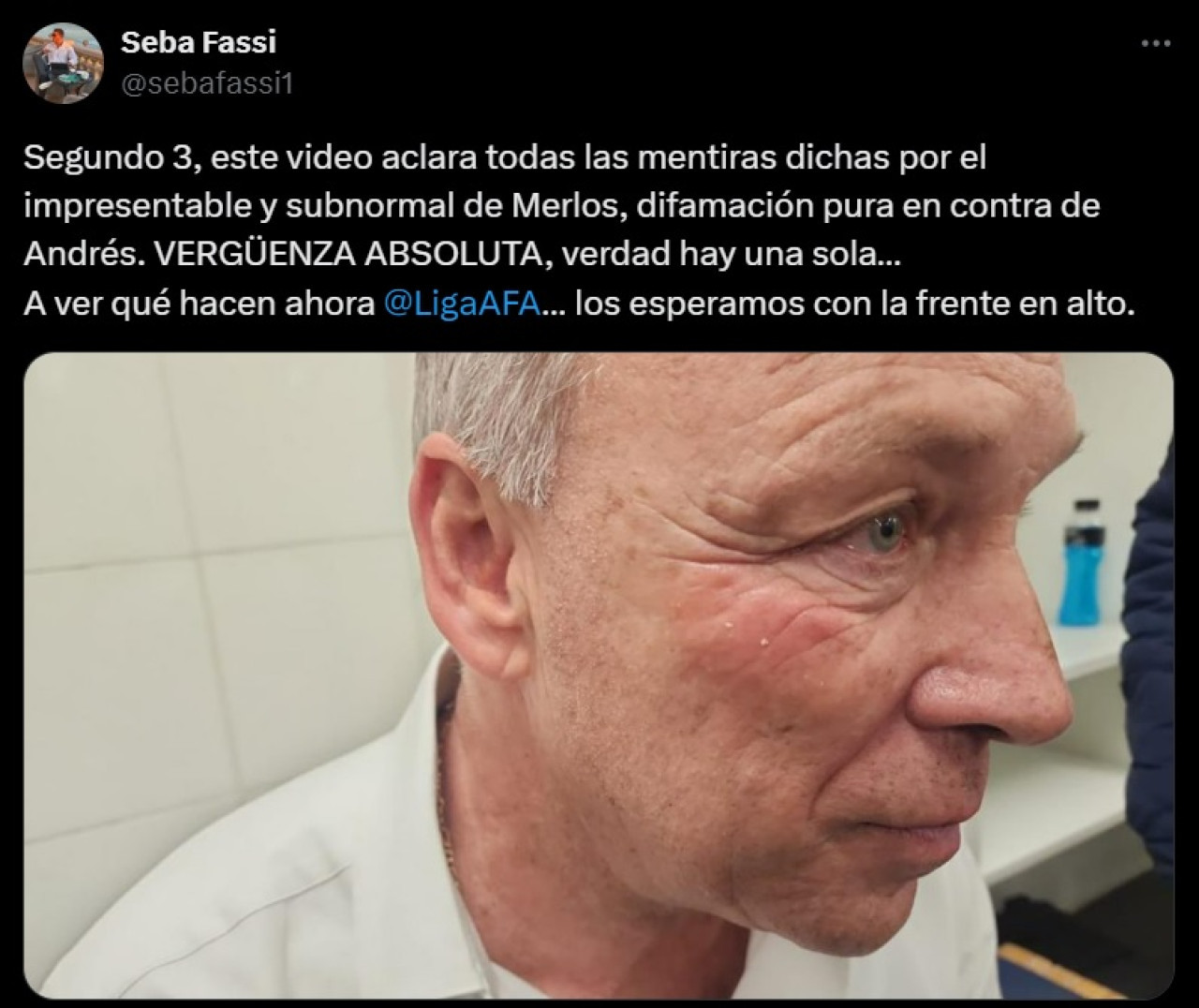 La fotografía que compartió el hijo de Andrés Fassi. Foto: X @sebafassi1.