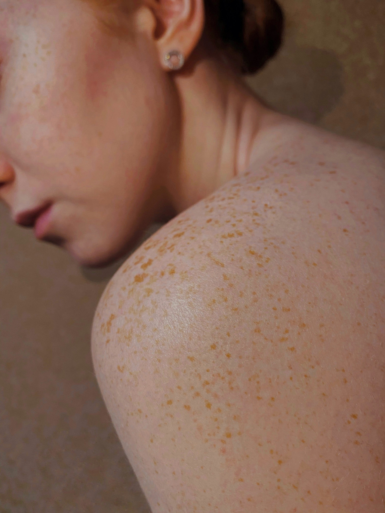 Piel. Foto Unsplash