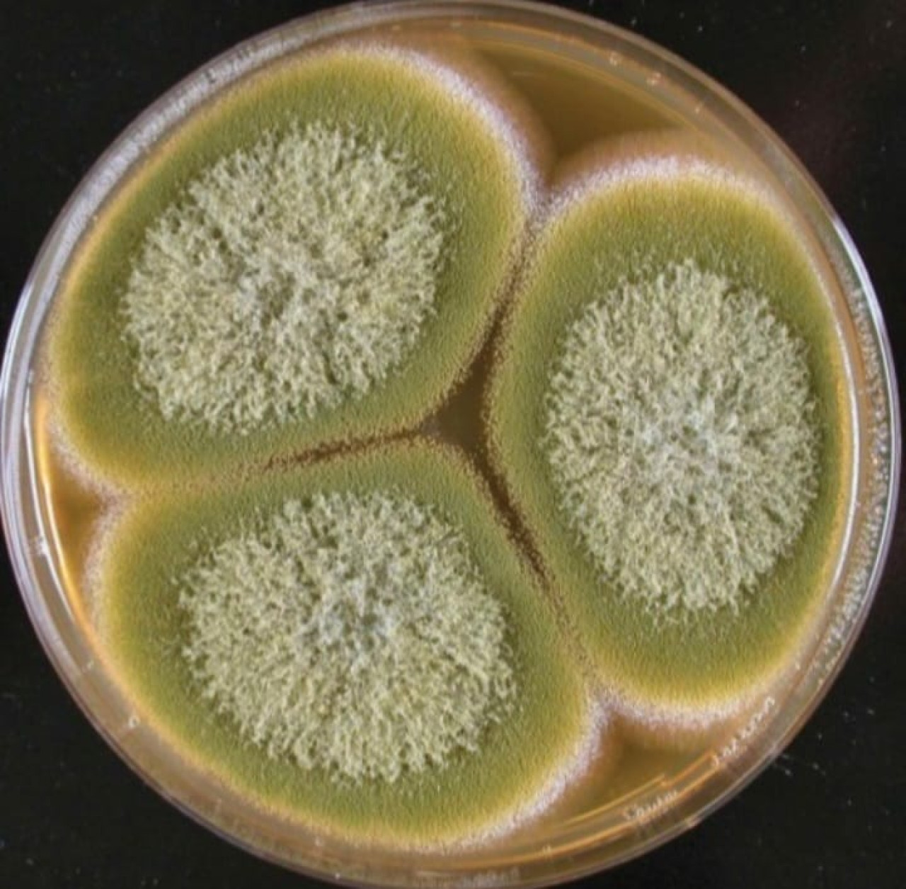 Hongo Aspergillus flavus. Foto: Facebook / Elmicrobiologist.
