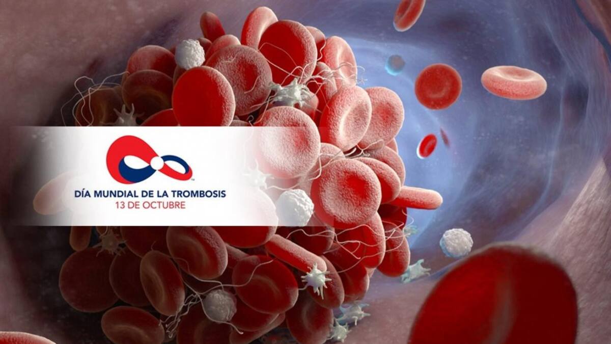 13 de octubre, Día Mundial de la Trombosis