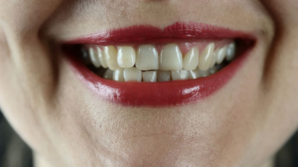 El aliado natural para una sonrisa más saludable y blanca. Foto: Unsplash.