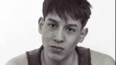 Ataque homófobo en Palermo: un joven fue brutalmente golpeado y sufrió una doble fractura de mandíbula