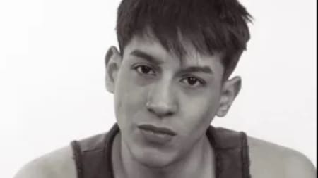 Ataque homófobo en Palermo: un joven fue brutalmente golpeado y sufrió una doble fractura de mandíbula