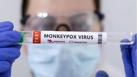 Viruela del Mono. Reuters