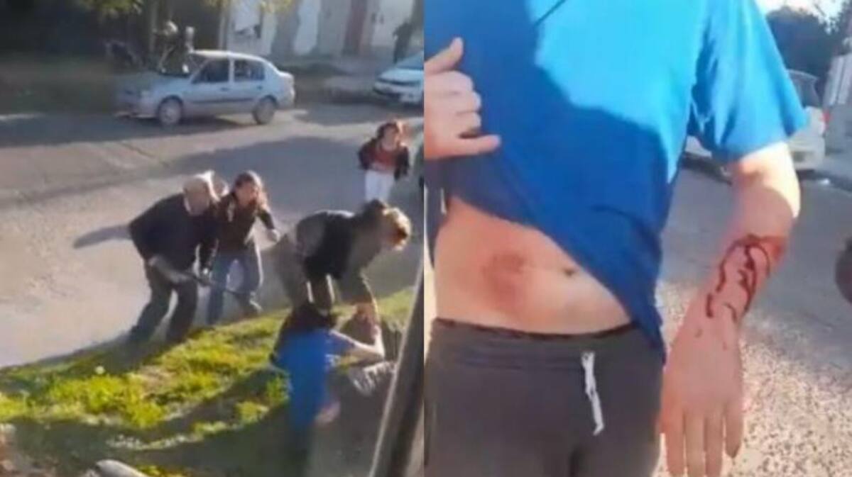 Ataque de un pitbull a un hombre en Bahía Blanca. Foto: NA