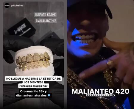 Los nuevos dientes de L-Gante. Foto: Instagram.