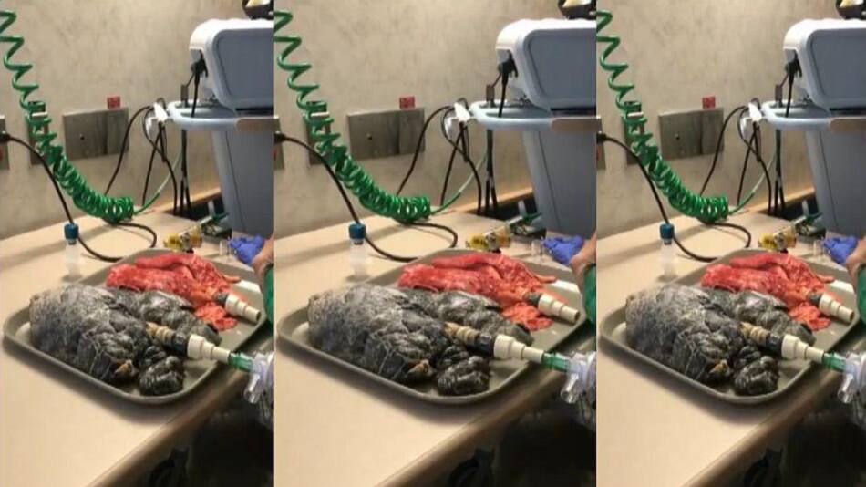 Pulmones - funcionamiento