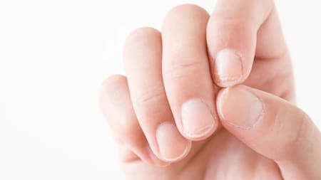Alerta: qué significan las rayas en las uñas y cómo pueden traducirse en nuestra salud