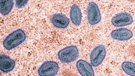 Mpox, viruela símica. Foto: Unsplash.