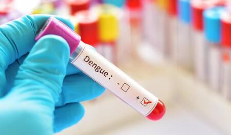 Dengue, enfermedad. Foto: NA