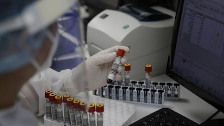 Viruela del mono, enfermedad. Foto: EFE.