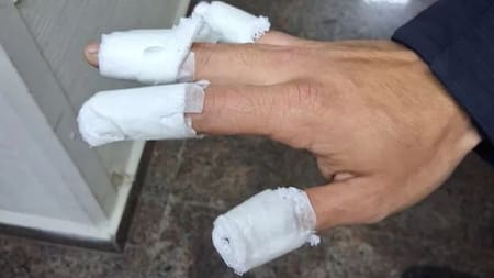 Adolescentes quemaron a un policía con una bomba molotov. Fuente: Agencia Noticias Argentinas / Policía de Córdoba