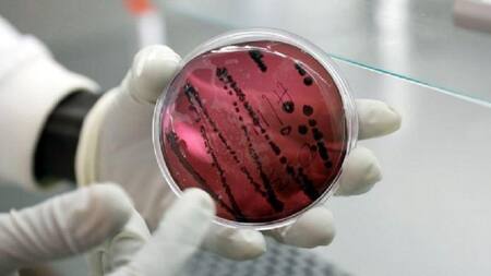 Chapare el nuevo virus que surge en Bolivia