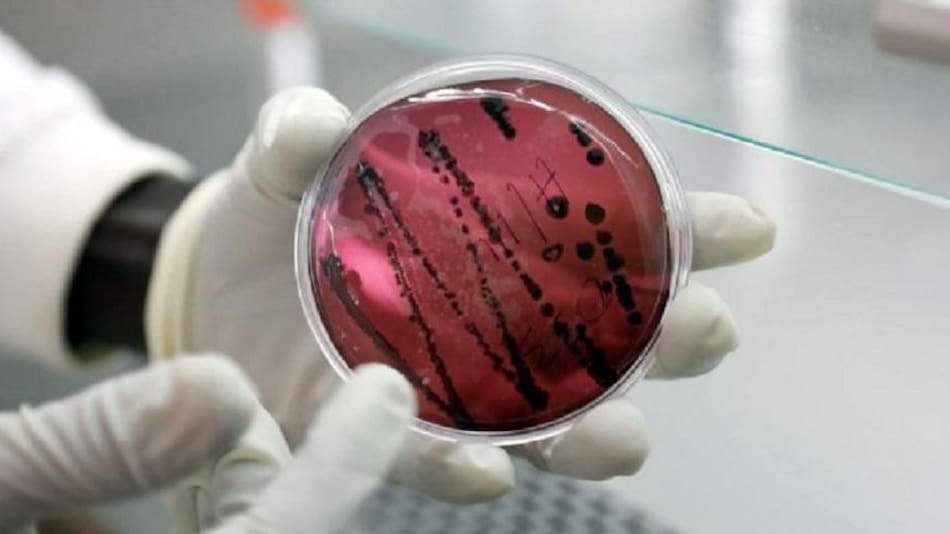 Chapare el nuevo virus que surge en Bolivia