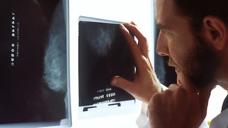 Cáncer; médico. Foto: Unsplash.