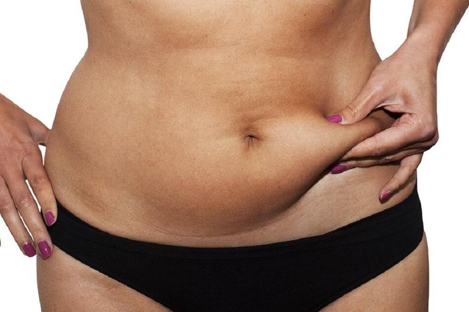 Carboxiterapia - salud