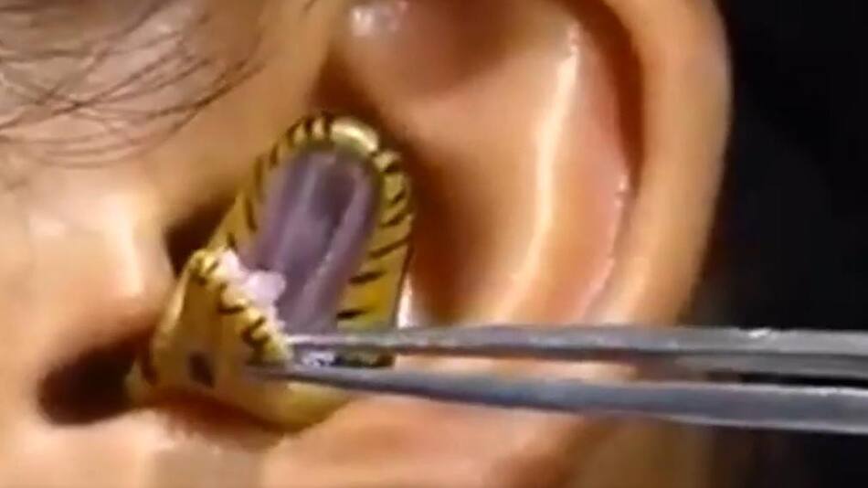 Serpiente en la oreja. Foto: captura de video.