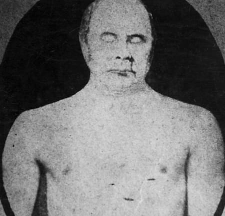 Foto al cadáver de Justo José de Urquiza