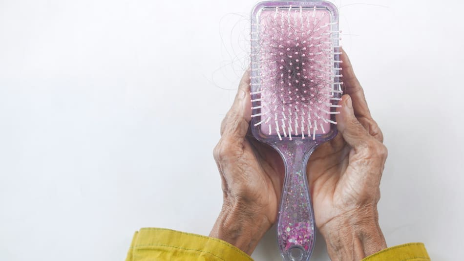 Caída de cabello. Foto: Unsplash