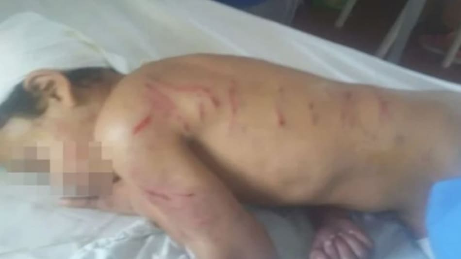 El menor que fue atacado por una jauría en Mar del Plata. Foto: NA.