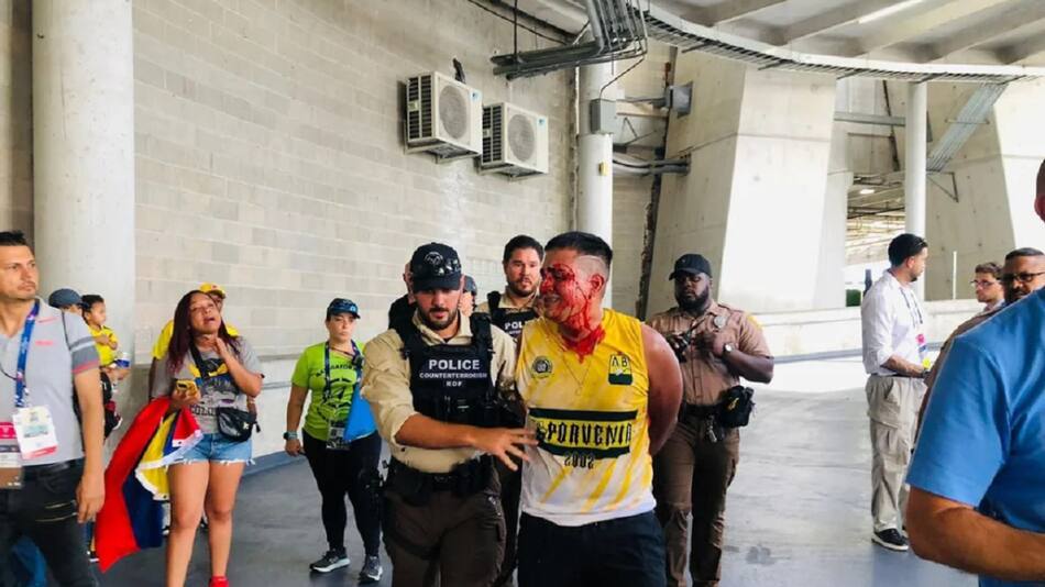 La previa de la final de la Copa América 2024. Foto: Reuters.