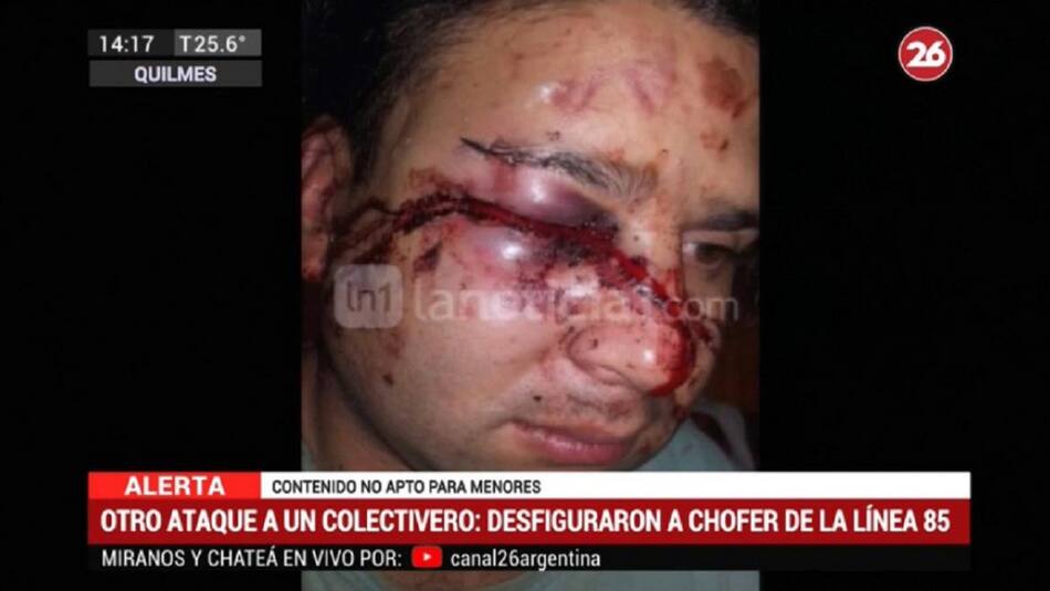 Otro ataque a colectivero - le desfiguraron la cara a chofer de línea 85
