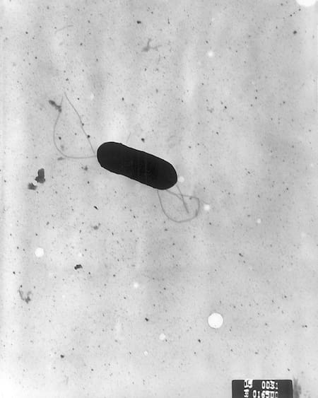Bacteria Listeria monocytogenes. Foto: Wikipedia.