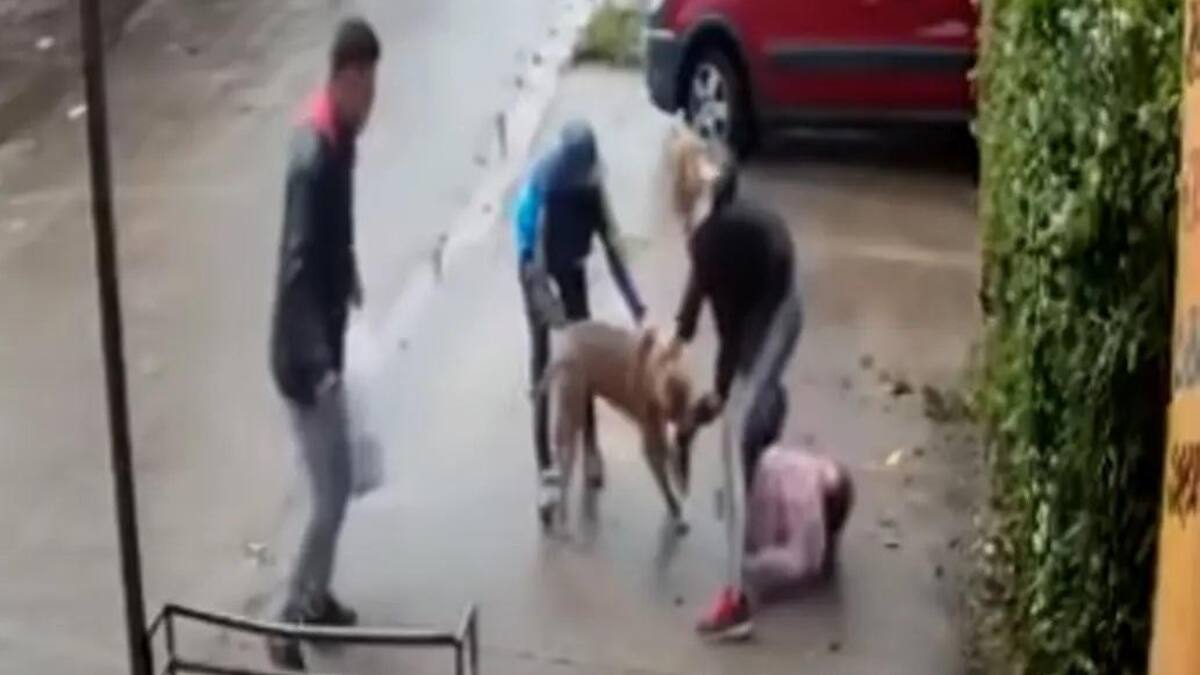 Ataque de Pitbull a niña