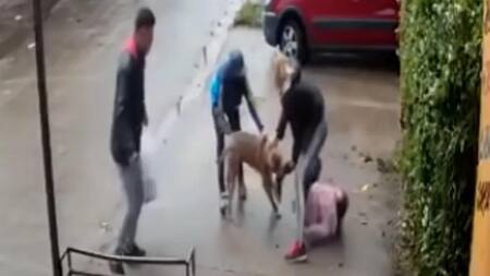 Ataque de Pitbull a niña