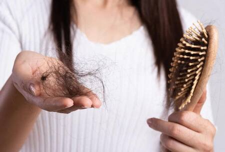 Pelo, caída del pelo, caída del cabello, NA