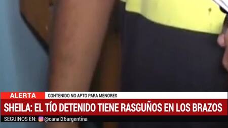 Crimen de Sheila: brazos de Fabían Gonzalez Rojas, acusado