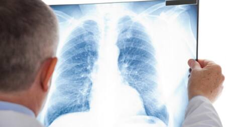 Aprueban una nueva droga para un subtipo de cáncer de pulmón