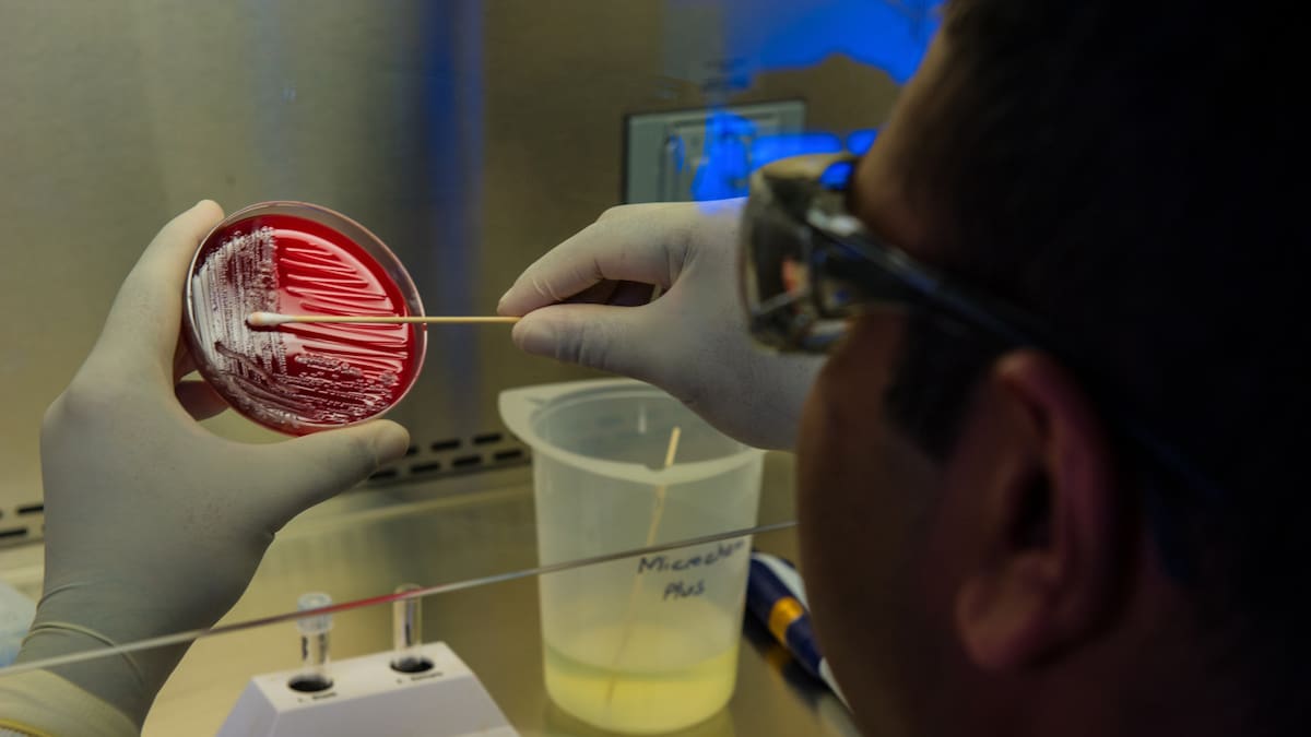 Virus Marburgo: síntomas, transmisión y el riesgo sanitario que enfrenta la región. Foto: Unsplash.