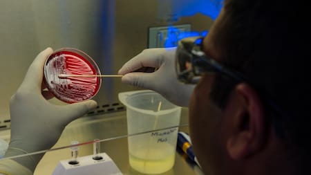 Alerta por el virus de Marburgo: qué es, cómo se contagia y por qué genera preocupación internacional