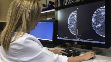 Metástasis. Foto: EFE.