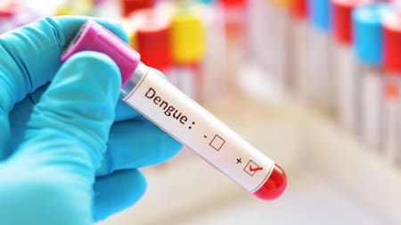 Dengue, enfermedad. Foto: NA