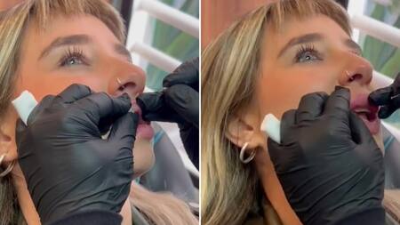 Paloma mostró "las pelotitas" que le sacaron de sus labios. Foto: capturas de video