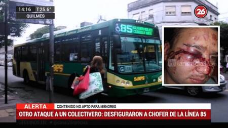Otro ataque a colectivero - le desfiguraron la cara a chofer de línea 85