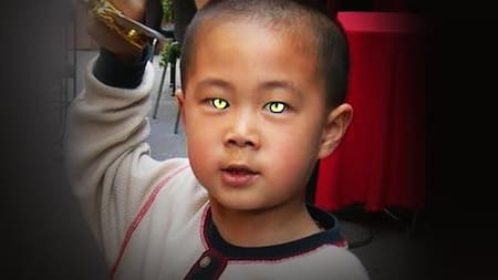 Nong Youhui, el "niño gato" que ve en la oscuridad