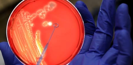 Bacterias en análisis de la Escherichia coli. Foto: EFE