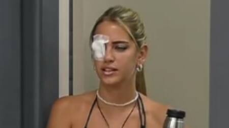 Sabrina apareció con un parche en el ojo. Foto: captura Telefe.