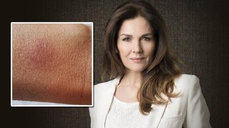 Andrea Frigerio - Ataque de motochorros