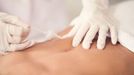 Carboxiterapia - salud