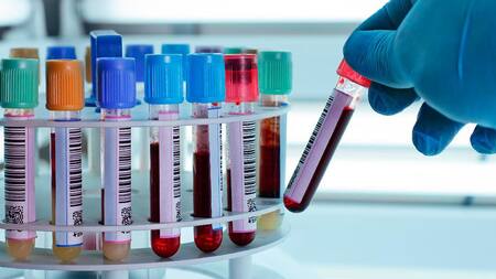 Laboratorios, coronavirus